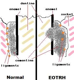 eotrh diagram